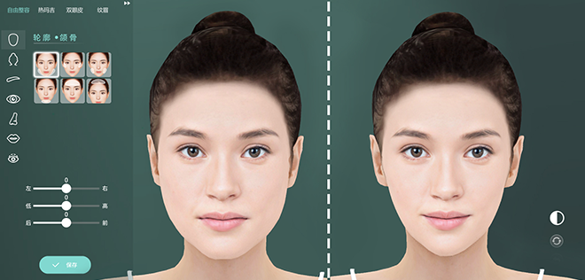 什么是數(shù)字3D整形？